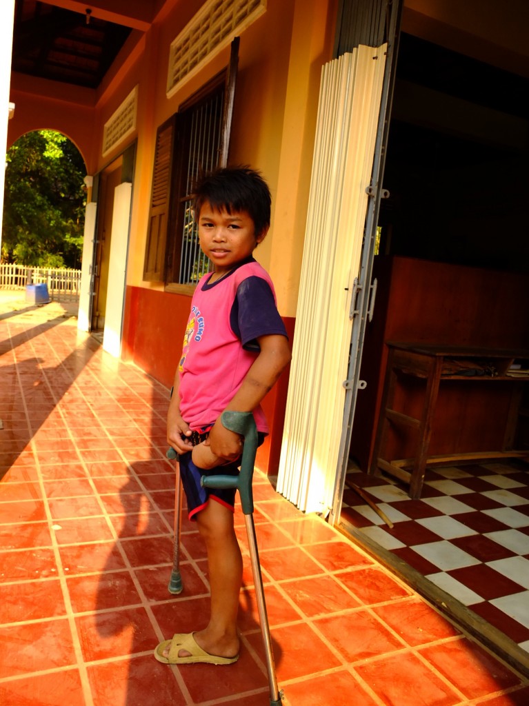 cambodia_amputee_assistance_theropy_025