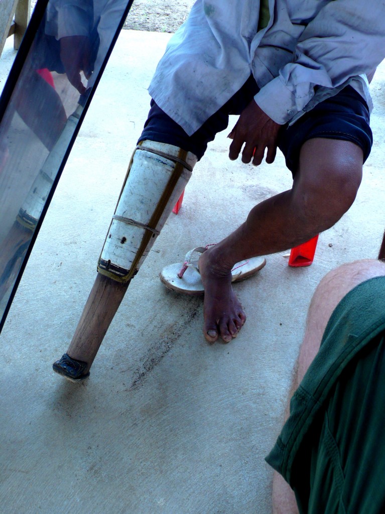 cambodia_amputee_assistance_theropy_045