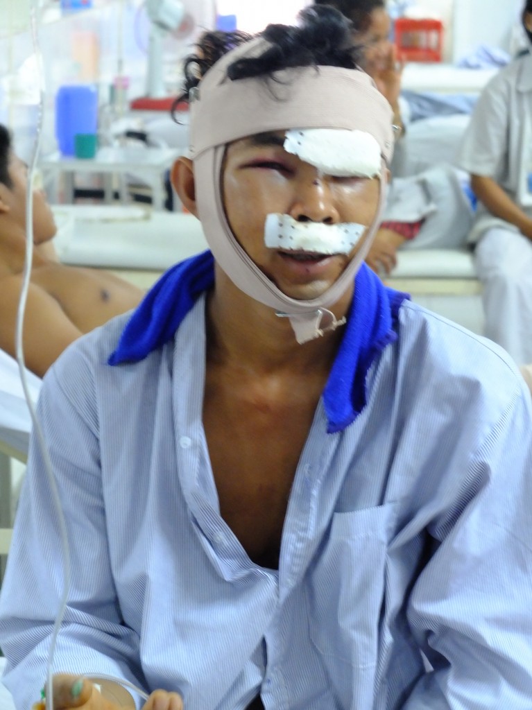 cambodia_amputee_assistance_theropy_150