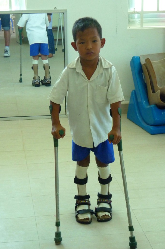 cambodia_amputee_assistance_theropy_165