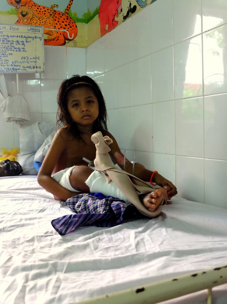 cambodia_amputee_assistance_theropy_225