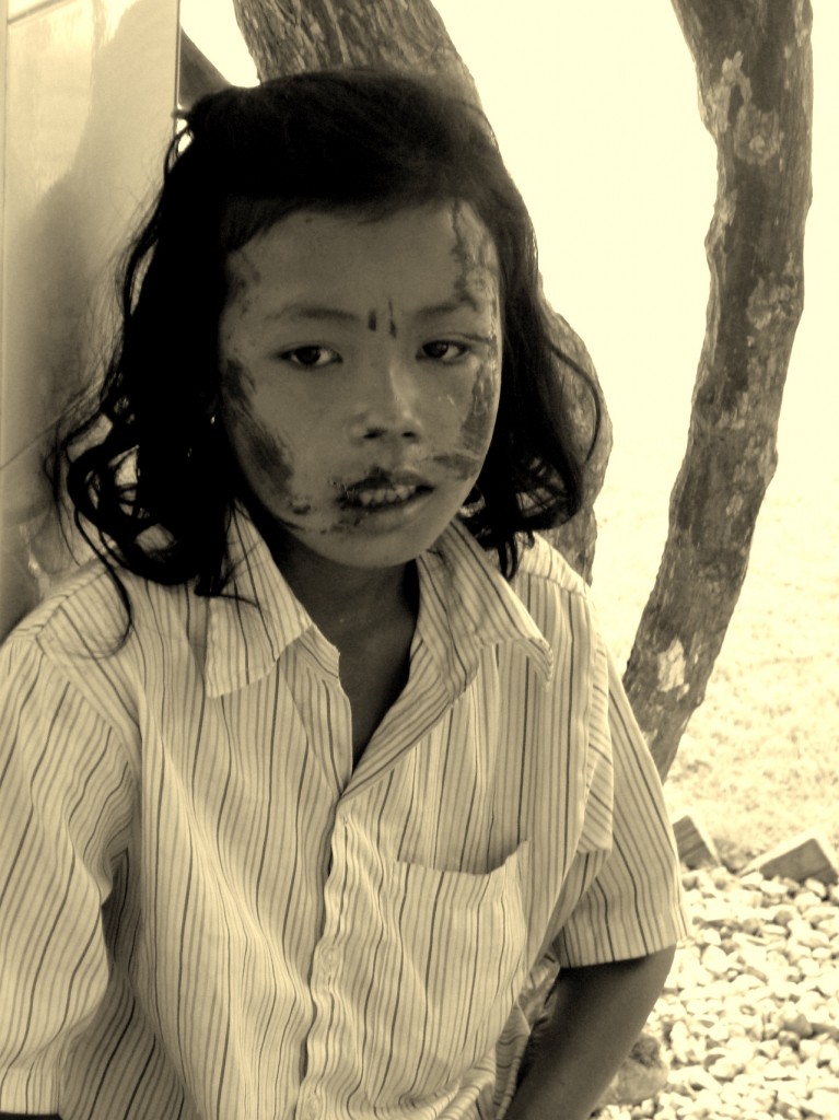 cambodia_amputee_assistance_theropy_455