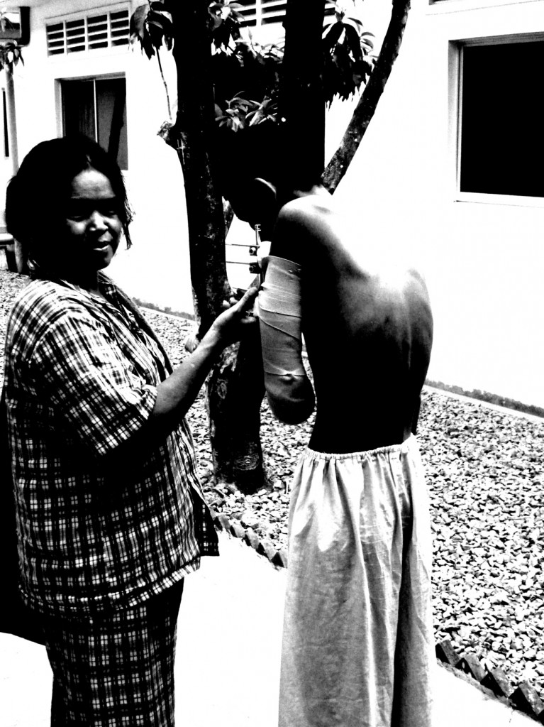 cambodia_amputee_assistance_theropy_630