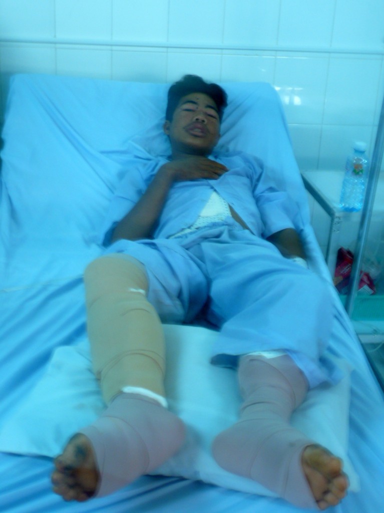 cambodia_amputee_assistance_theropy_655
