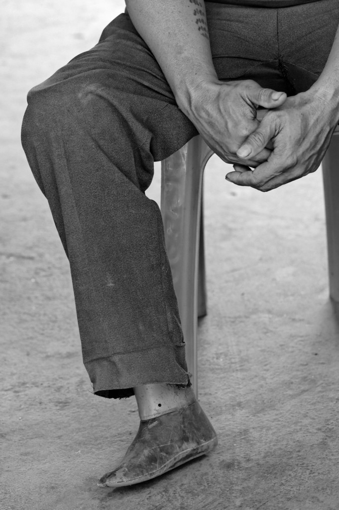 cambodia_amputee_assistance_theropy_690